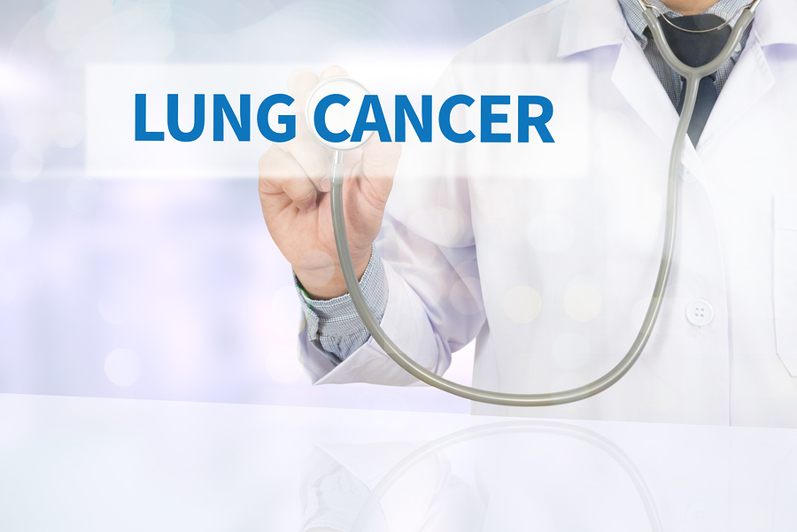Home Care in Los Gatos CA: Things to Know About Lung Cancer