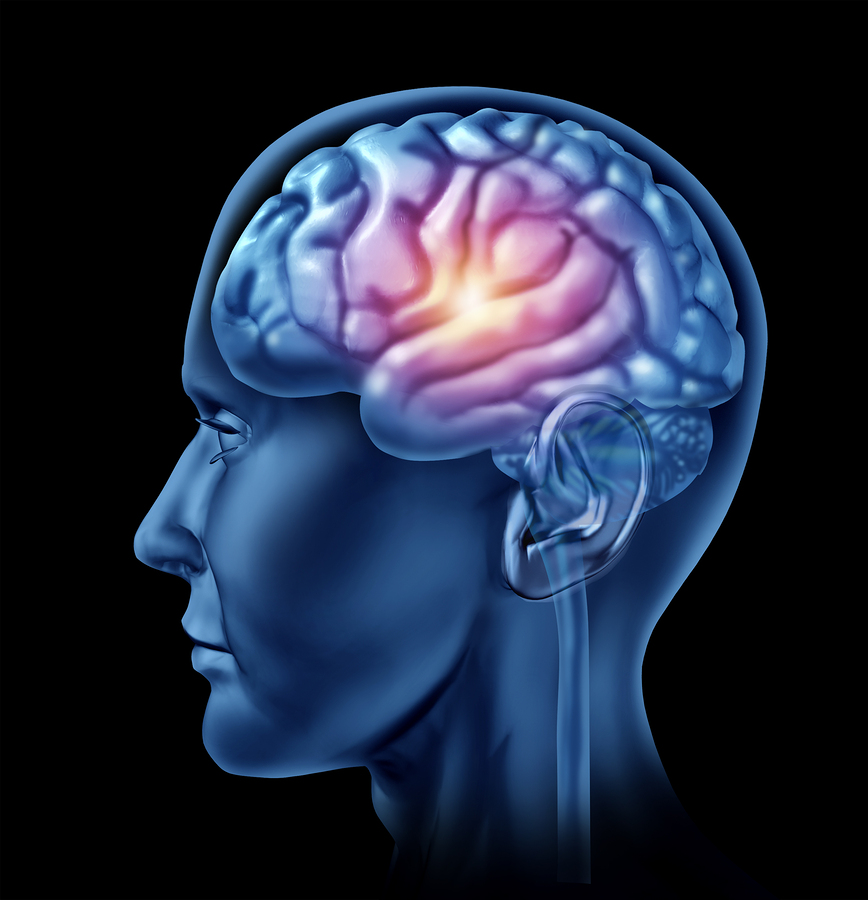 Senior Care in Saratoga CA: Traumatic Brain Injuries