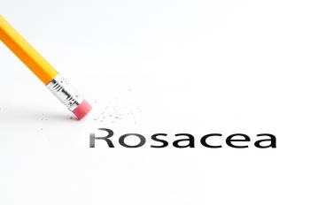Image for Is Rosacea Affecting Your Ability to Care for Your Parents?