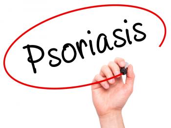 Image for What Is Psoriasis and How Can You Help Your Senior to Cope with It?