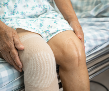 How Elder Care Helps Seniors Recover From Knee Replacement Surgery